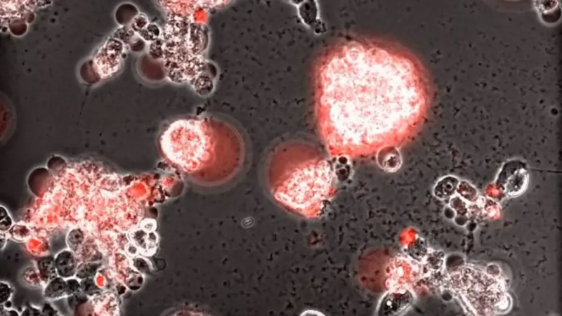 فيديو مذهل.. هكذا يغزو فيروس كورونا خلايا الدماغ