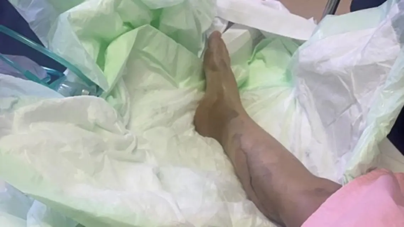 تفاصيل مروعة عن حارق زوجته بالأسيد في جدة.. وهذه وصيتها