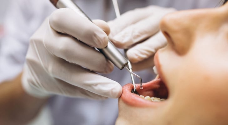 رصد 12 حالة انتحال صفة طبيب أسنان في الأردن