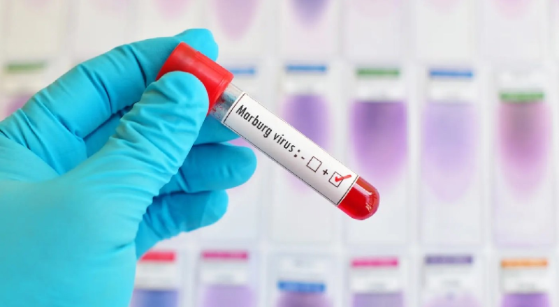 الصحة :  الأردن لم يستقبل أي شخص من الدول التي انتشر فيها فيروس ماربورغ