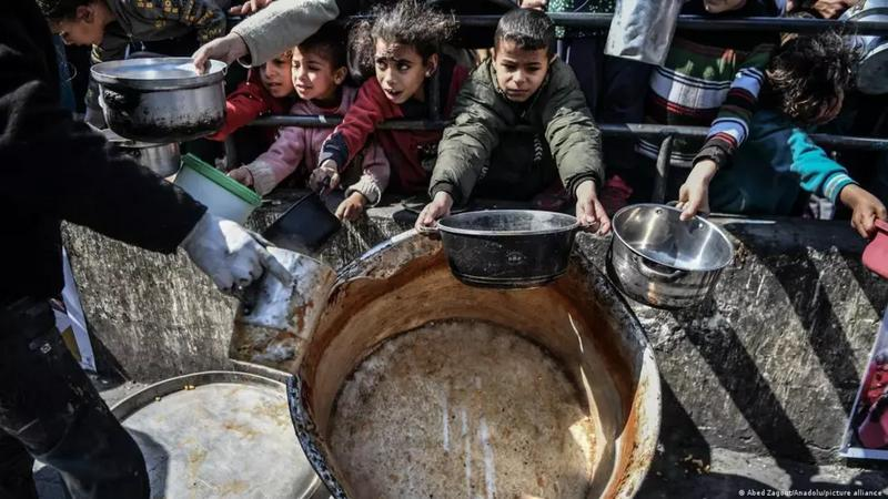 استشهاد 30 طفلاً نتيجة المجاعة في غزة