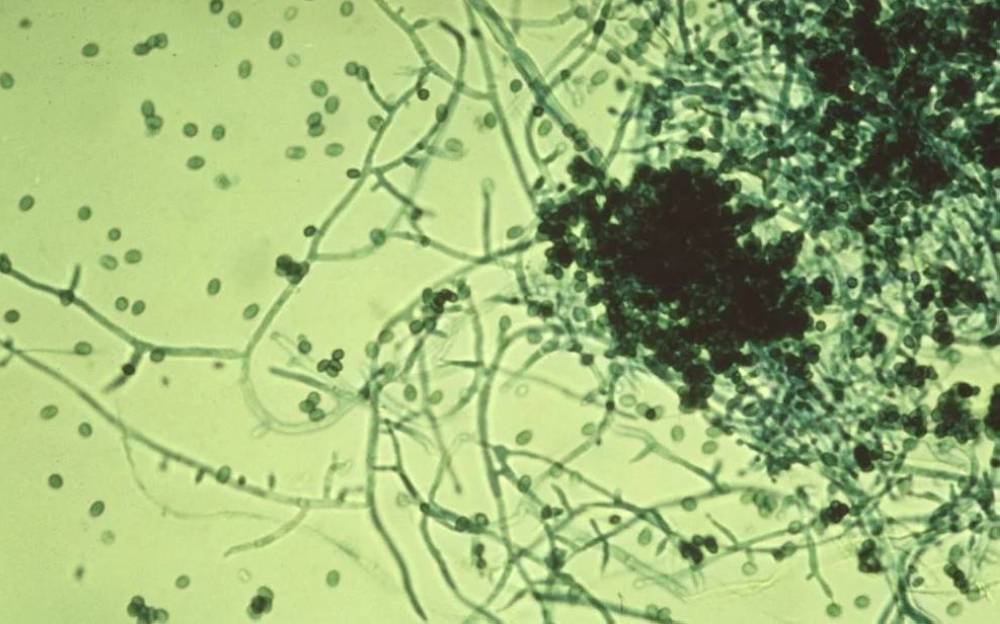 اكتشاف نوع جديد من الفطريات وتسجيله عالمياً