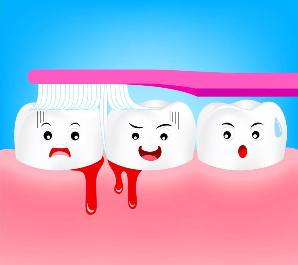 متى يكون نزيف اللثة علامة تحذير؟