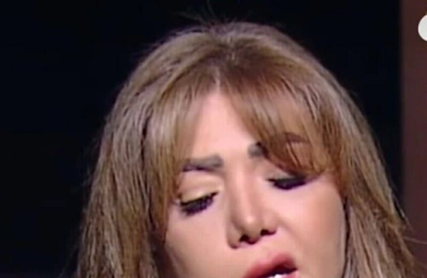 فنانة مصرية شهيرة تروي مأساة إصابتها بـشلل الوجه