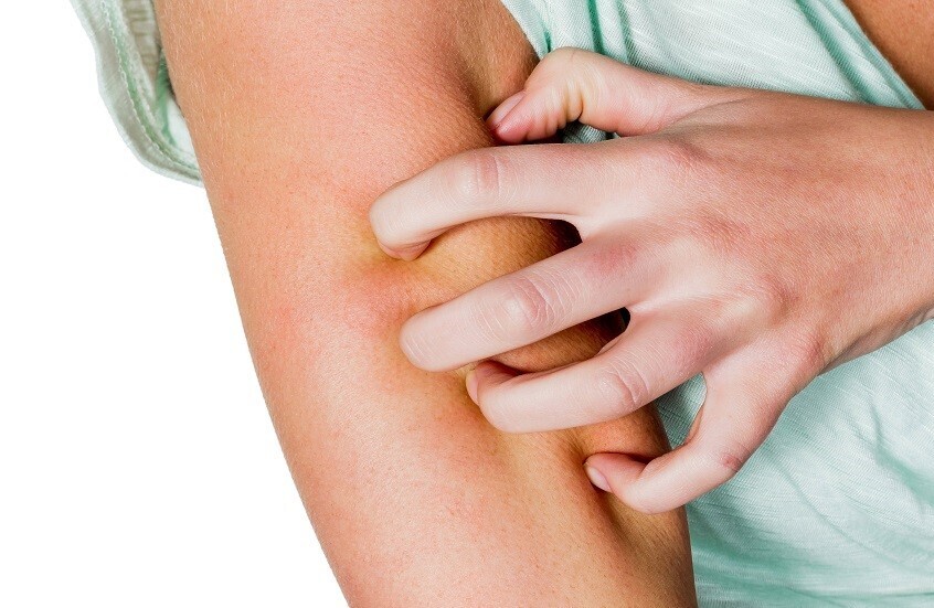 عارض خفي لمشكلات في الكبد