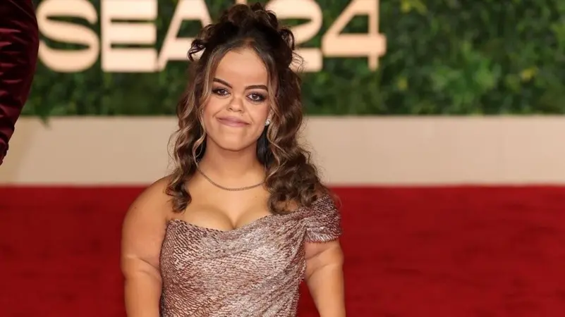 هل تعرفهم؟.. فنانون من ذوي الهمم يغزون الدراما والسينما المصرية