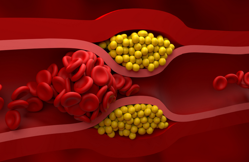 سرّ صحي في الأطعمة المخمّرة